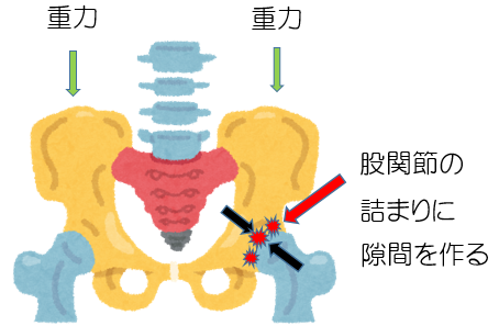 股関節の痛み イメージ図
