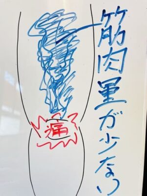 ふとももの筋肉が少ない　イラスト解説